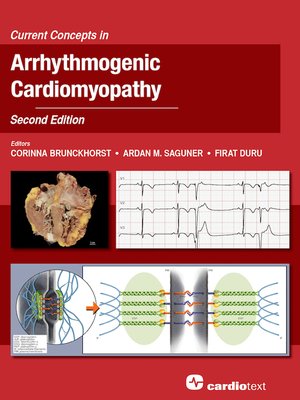 cover image of Current Concepts in Arrhythmogenic Cardiomyopathy